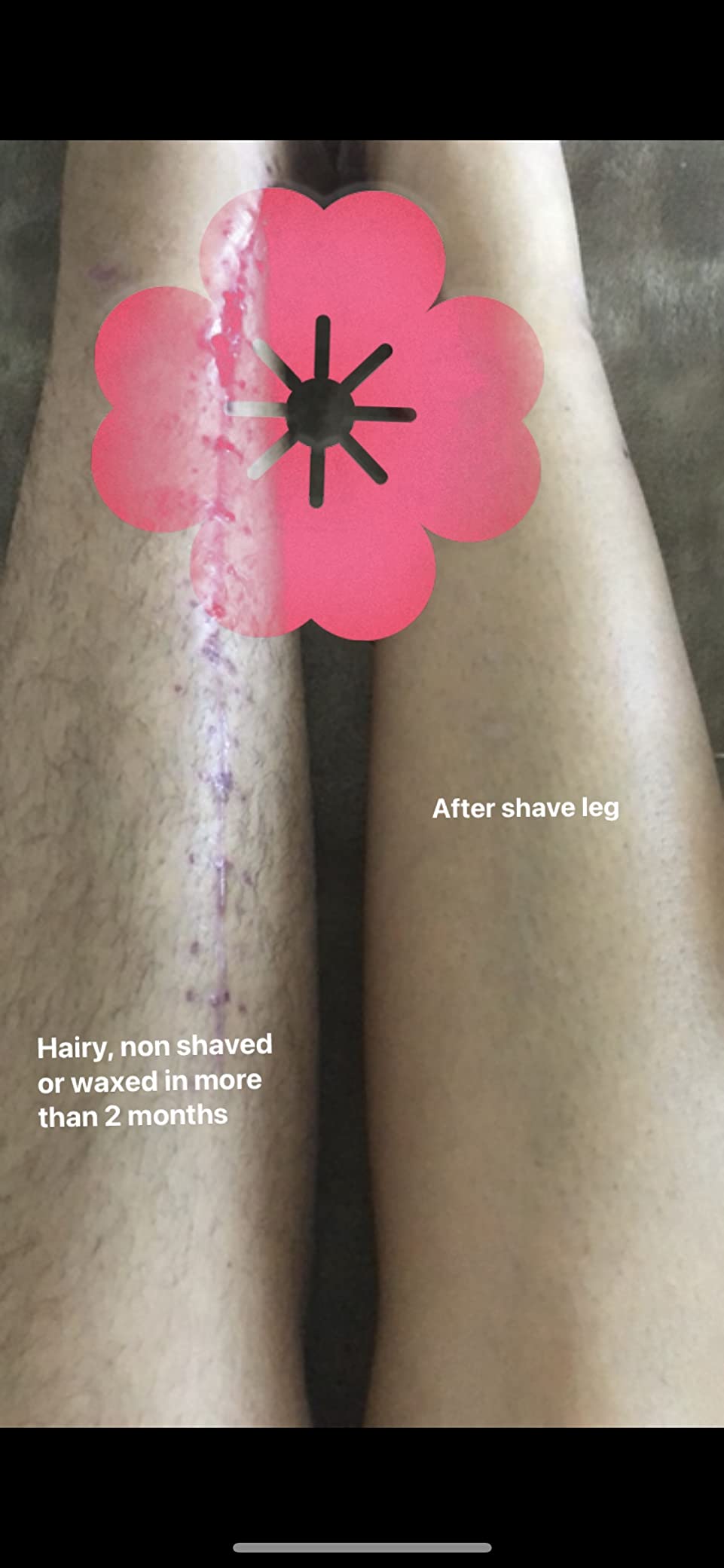 Braun IPL, Silk·Expert Pro 5, IPL Hair Removal for Women and Men, Permanent Laser Hair Reduction At-Home, 2 Heads, Pouch, Venus Razor, IPL5157 customer photo 1