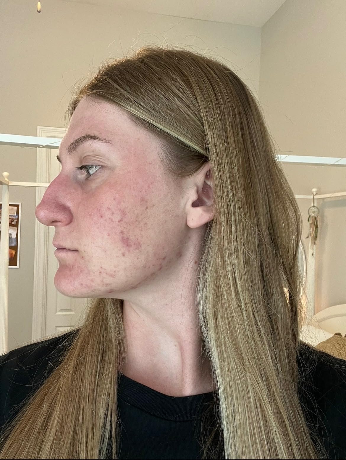 PMD Wave Pro - Professional-Grade Advanced Skin Spatula - Extract, Infuse, & Lift - SonicGlow Vibration and E-Wave Technology - Clear Pores, Blackheads, & Whiteheads customer photo 1