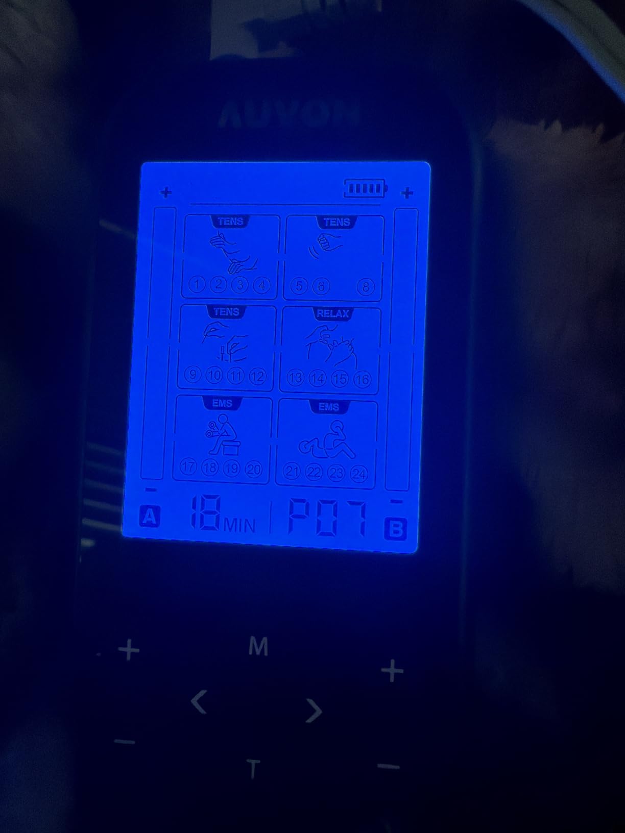 AUVON 3-in-1 TENS Unit Muscle Stimulator, 40 Levels for Gradual Pain Relief | EMS Massage Machine, Drug-Free for Shoulder, Sciatica, Back Pain Relief, 24 Modes Electronic Pulse Massager, 12 TENS Pads customer photo 1