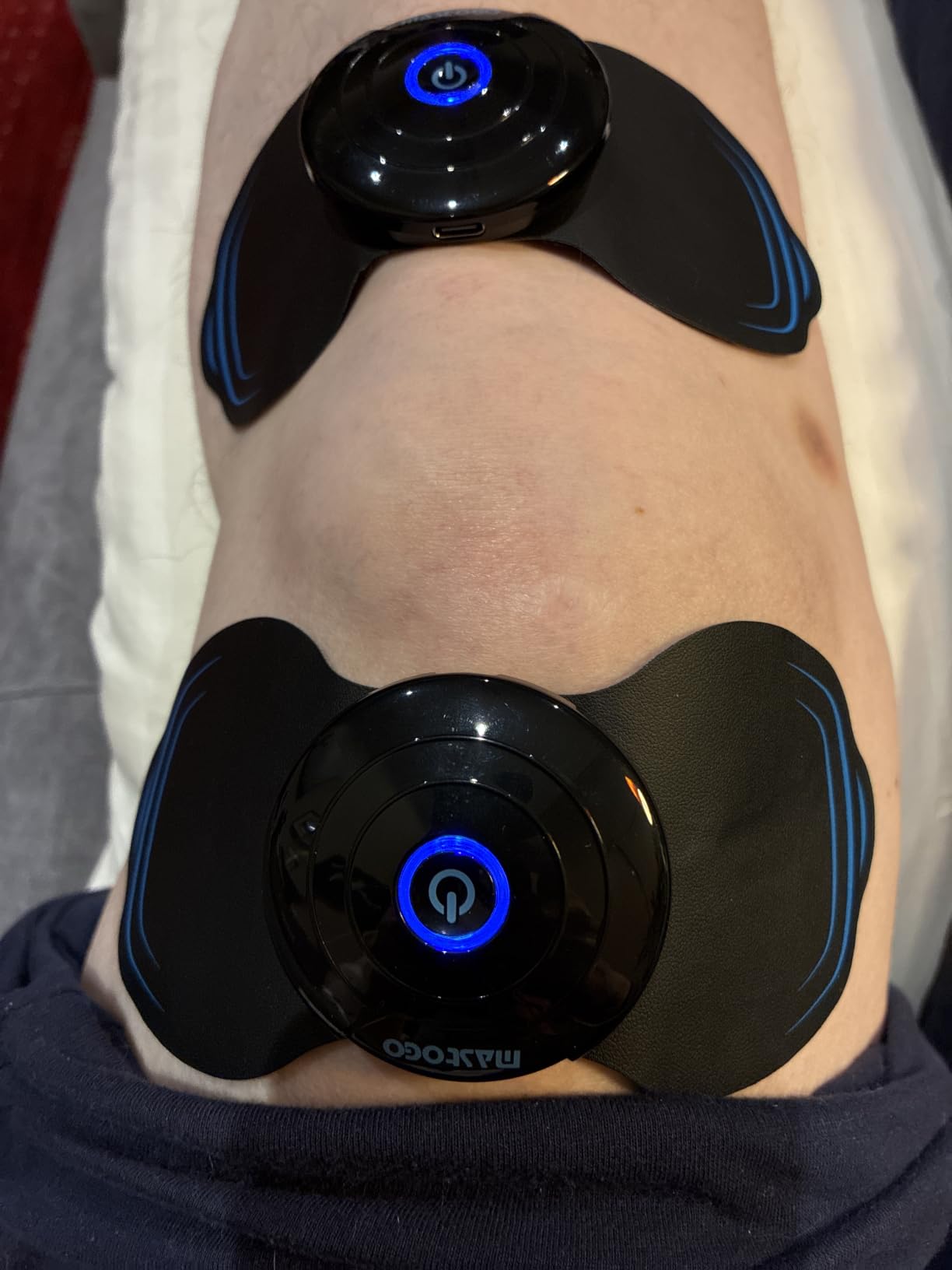 MASTOGO 12 Modes Wireless TENS Unit Muscle Stimulator for Pain Relief | App-Controlled TENS Machine, Dual Channel, Independent Control, 20 Intensity Levels, Shoulder, Neck Pain Relief, 8 PCS Pads customer photo 2