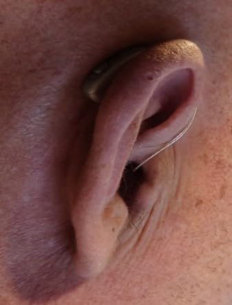 Jabra Enhance Select 700 Clinic-Quality OTC Hearing Aids with Audiology Support, Bluetooth LE Audio & Streaming for iOS/Android, Nearly Invisible & Comfortable customer photo 1